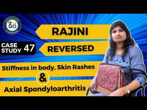 Rajini Reversed Axial Spondyloarthritis, Skin Rashes, and Stiffness in body || Vishal Saini.