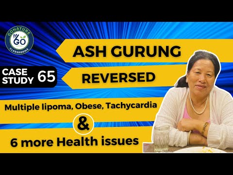 Ash reversed Multiple lipoma, Obese, Tachycardia and many more health issues.